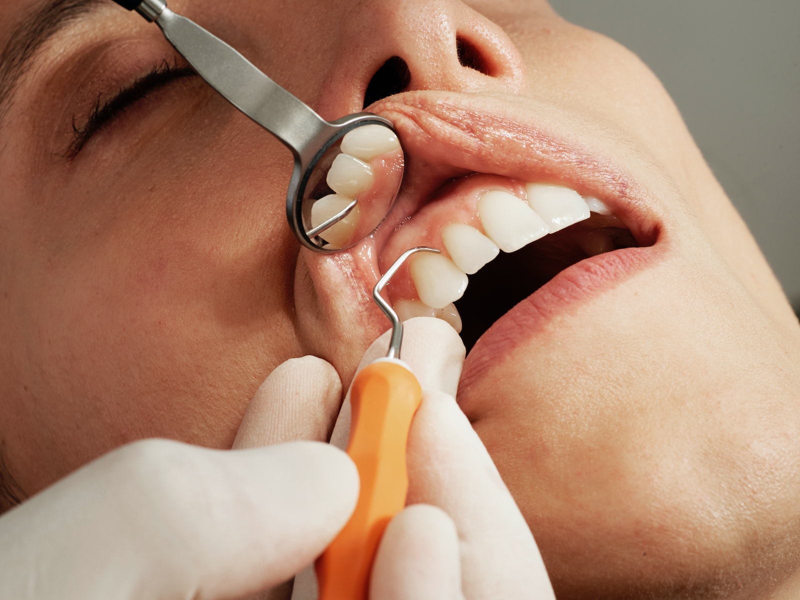 Tips And Strategies For Reducing The Cost Of Dental Treatment