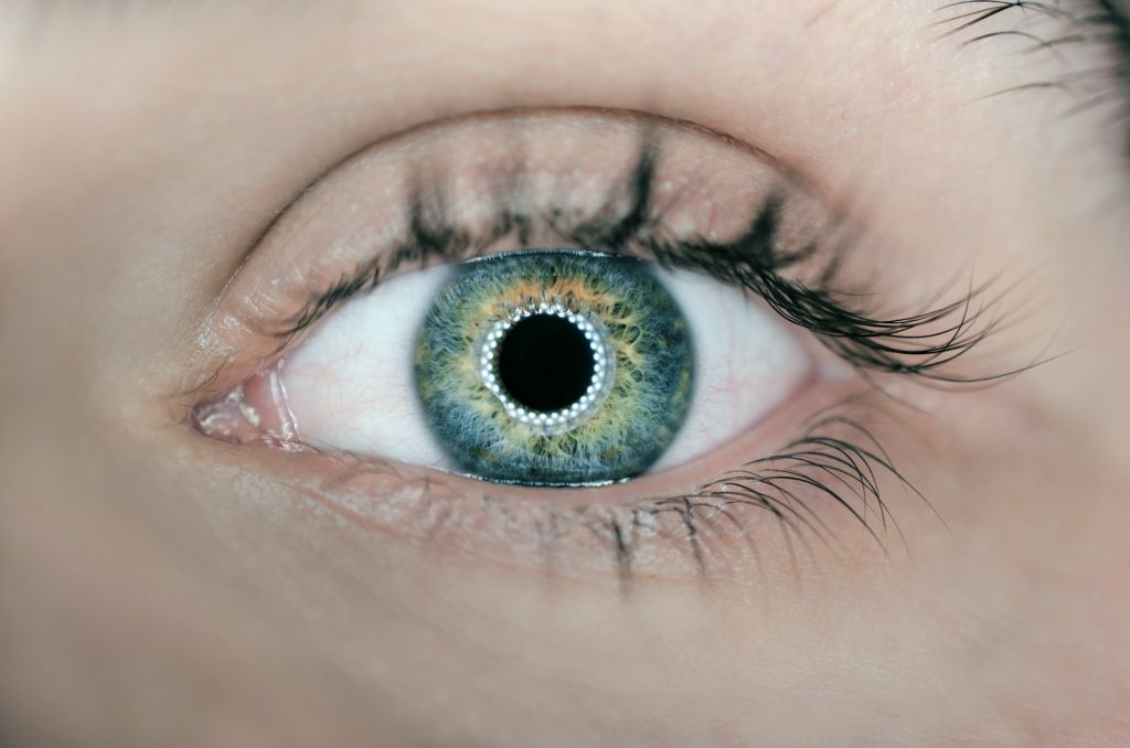 laser eye surgery