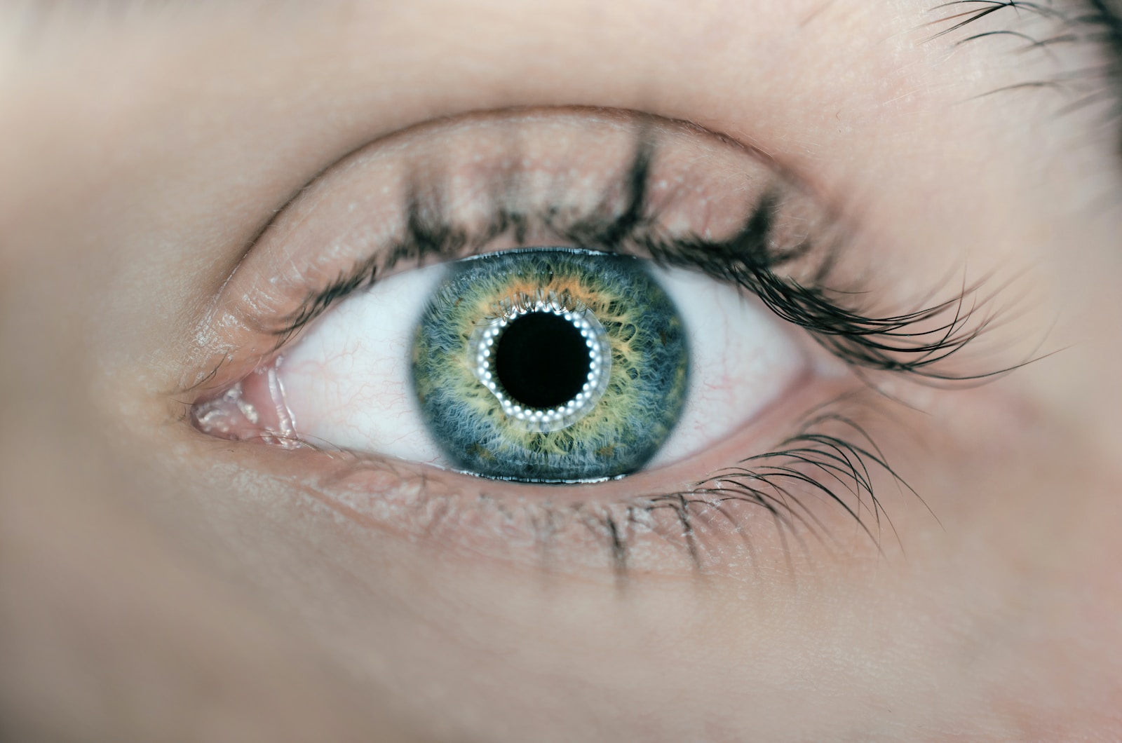 What To Expect Before During And After Laser Eye Surgery
